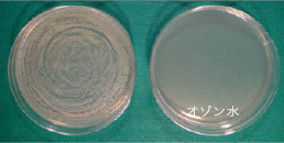 Escherichia coli 0 -111 (病原大腸菌)