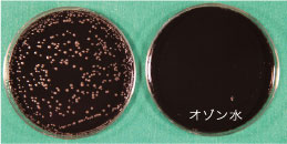 Campylobacter jejuni (カンピロバクター菌)